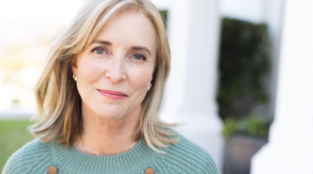 skaneateles facelift neck lift model